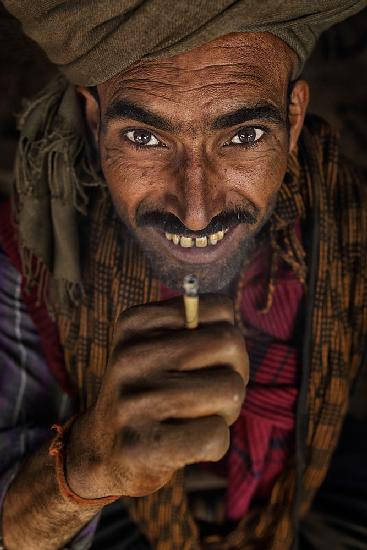 smoker smile