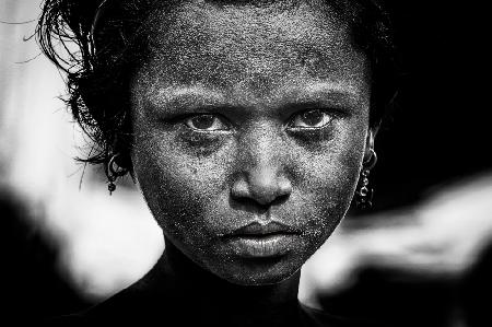 Rohingya refugee girl - Bangladesh